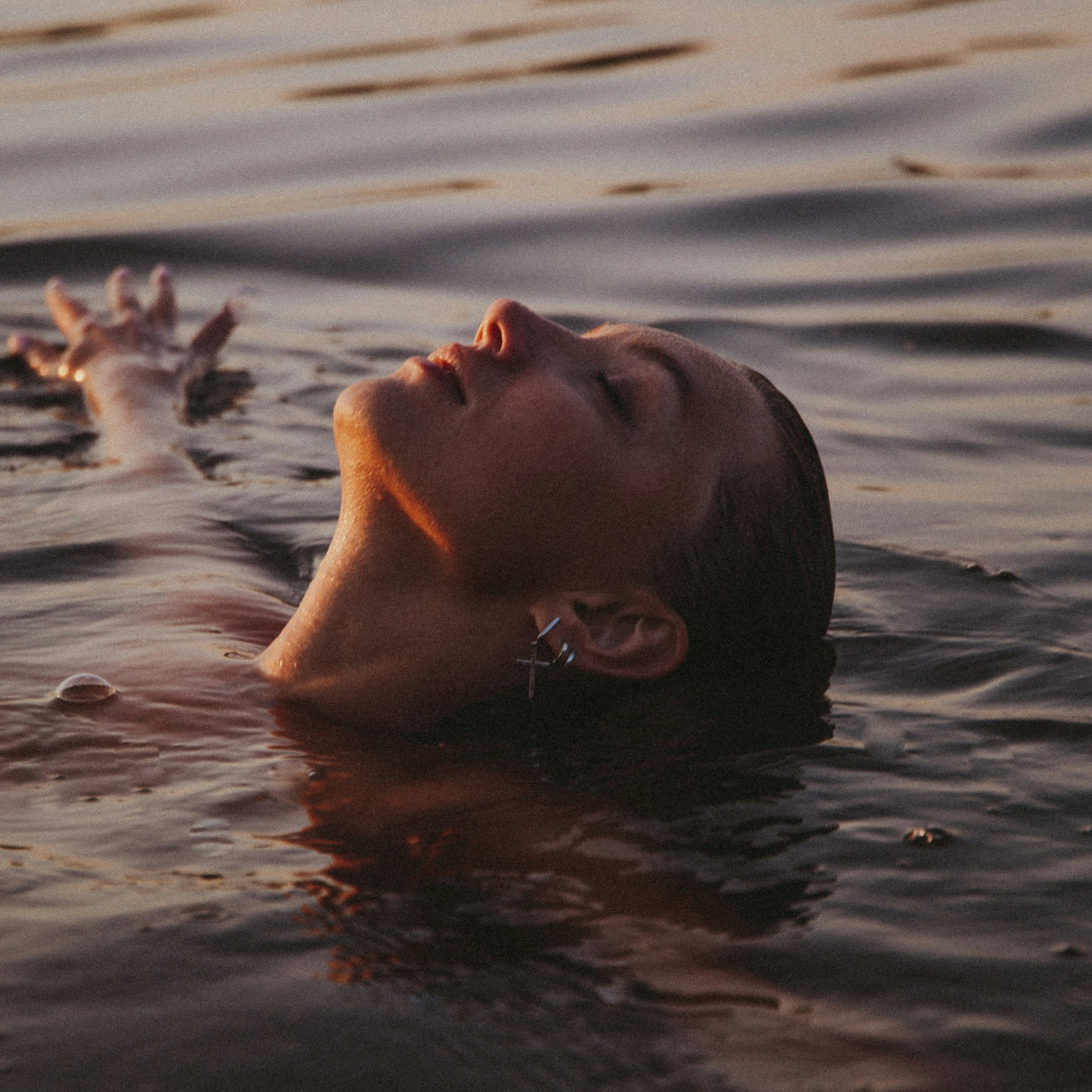 Is Your Moisturizer Contributing to Acne?