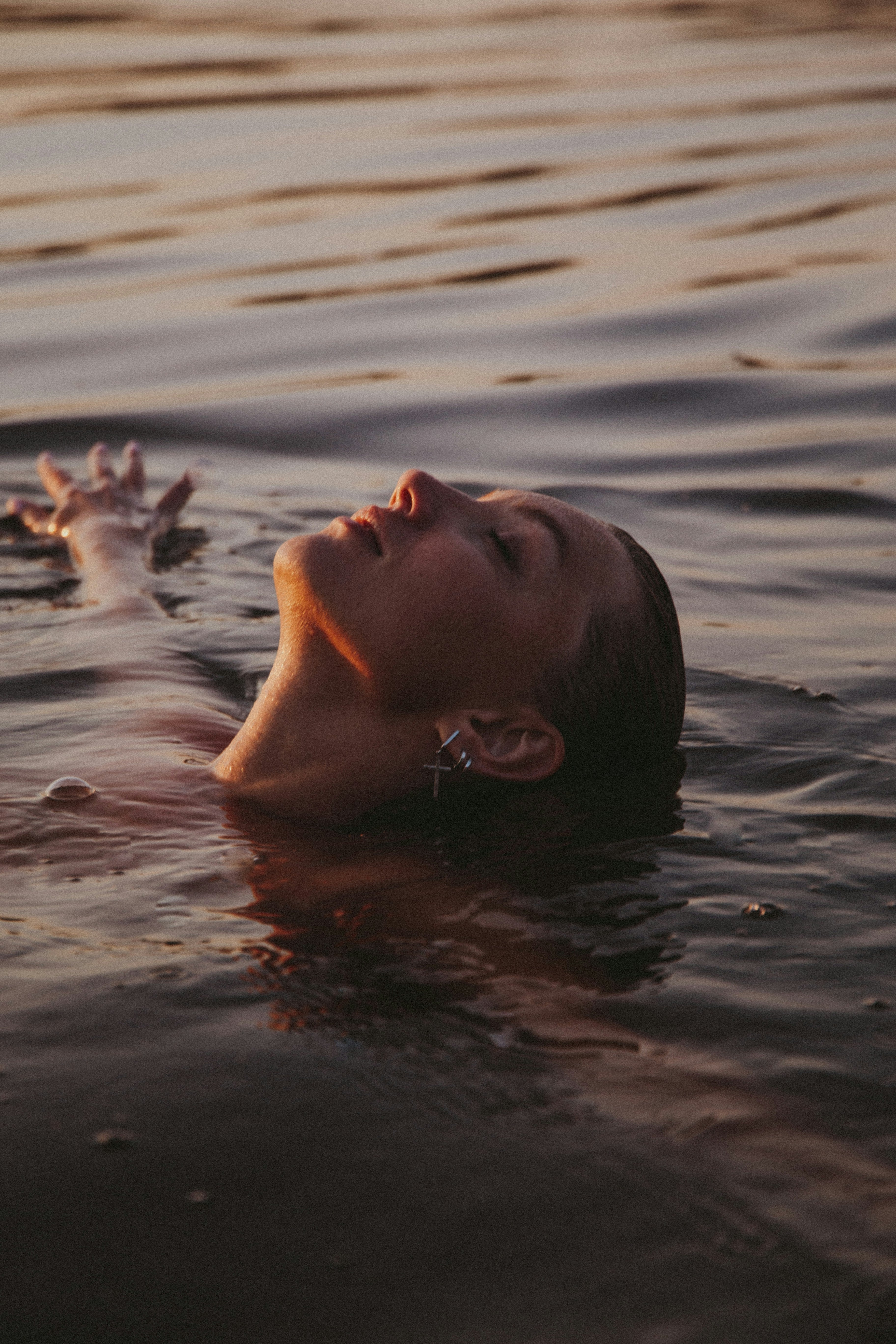 Is Your Moisturizer Contributing to Acne?